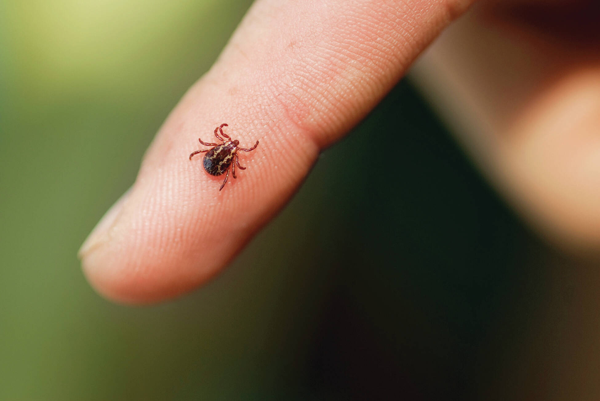 First locally acquired human case of tick-borne anaplasmosis found in Washington state